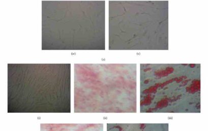 Molecular characterization of mesenchymal stem cells